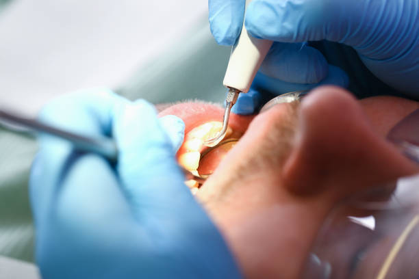 Best Emergency Tooth Extraction  in Marlin, TX